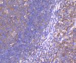 CD10 Antibody in Immunohistochemistry (Paraffin) (IHC (P))