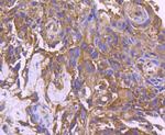 CD10 Antibody in Immunohistochemistry (Paraffin) (IHC (P))