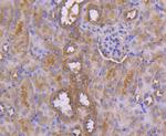 CD10 Antibody in Immunohistochemistry (Paraffin) (IHC (P))