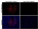 CD10 Antibody in Immunohistochemistry (Paraffin) (IHC (P))