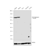 CD10 Antibody in Western Blot (WB)