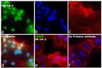 Caspase 6 p18 Antibody