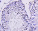 Cyclin H Antibody in Immunohistochemistry (Paraffin) (IHC (P))