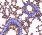 CD81 Antibody in Immunohistochemistry (Paraffin) (IHC (P))