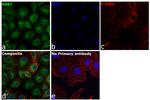 RAB7A Antibody in Immunocytochemistry (ICC/IF)