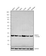 RAB7A Antibody in Western Blot (WB)