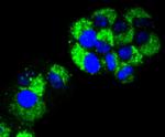 RAB7A Antibody in Immunocytochemistry (ICC/IF)