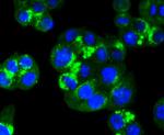 RAB7A Antibody in Immunocytochemistry (ICC/IF)