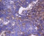 RAB7A Antibody in Immunohistochemistry (Paraffin) (IHC (P))