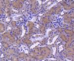 RAB7A Antibody in Immunohistochemistry (Paraffin) (IHC (P))