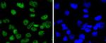 SMC1 Antibody in Immunocytochemistry (ICC/IF)