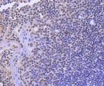 SMC1 Antibody in Immunohistochemistry (Paraffin) (IHC (P))