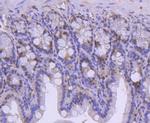 SMC1 Antibody in Immunohistochemistry (Paraffin) (IHC (P))