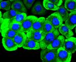 RET Antibody in Immunocytochemistry (ICC/IF)