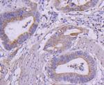 RET Antibody in Immunohistochemistry (Paraffin) (IHC (P))