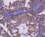 RET Antibody in Immunohistochemistry (Paraffin) (IHC (P))