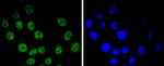 Cyclin E Antibody in Immunocytochemistry (ICC/IF)