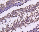 Cyclin B2 Antibody in Immunohistochemistry (Paraffin) (IHC (P))