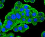 PDPK1 Antibody in Immunocytochemistry (ICC/IF)