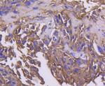 PDPK1 Antibody in Immunohistochemistry (Paraffin) (IHC (P))