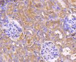 PDPK1 Antibody in Immunohistochemistry (Paraffin) (IHC (P))