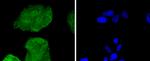 CDK6 Antibody in Immunocytochemistry (ICC/IF)