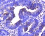 CDK6 Antibody in Immunohistochemistry (Paraffin) (IHC (P))