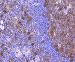 CDK6 Antibody in Immunohistochemistry (Paraffin) (IHC (P))