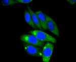 AP2M1 Antibody in Immunocytochemistry (ICC/IF)