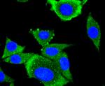 AP2M1 Antibody in Immunocytochemistry (ICC/IF)