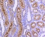 AP2M1 Antibody in Immunohistochemistry (Paraffin) (IHC (P))