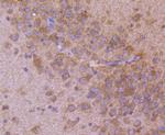 AP2M1 Antibody in Immunohistochemistry (Paraffin) (IHC (P))