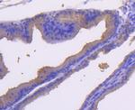 MKK7 Antibody in Immunohistochemistry (Paraffin) (IHC (P))