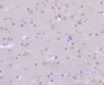 MKK7 Antibody in Immunohistochemistry (Paraffin) (IHC (P))