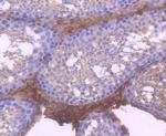 RUNX1/RUNX2/RUNX3 Antibody in Immunohistochemistry (Paraffin) (IHC (P))