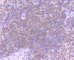 STIM1 Antibody in Immunohistochemistry (Paraffin) (IHC (P))