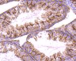 STIM1 Antibody in Immunohistochemistry (Paraffin) (IHC (P))