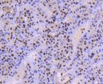 TRIM28 Antibody in Immunohistochemistry (Paraffin) (IHC (P))