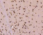 TRIM28 Antibody in Immunohistochemistry (Paraffin) (IHC (P))