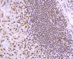 TRIM28 Antibody in Immunohistochemistry (Paraffin) (IHC (P))