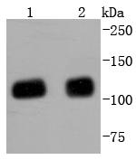 TRIM28 Antibody in Western Blot (WB)