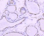 PAX8 Antibody in Immunohistochemistry (Paraffin) (IHC (P))