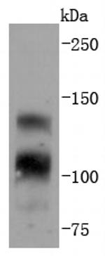 FGFR1 Antibody in Western Blot (WB)