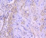 FOXO4 Antibody in Immunohistochemistry (Paraffin) (IHC (P))