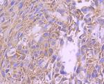 FOXO4 Antibody in Immunohistochemistry (Paraffin) (IHC (P))