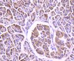 FOXO4 Antibody in Immunohistochemistry (Paraffin) (IHC (P))