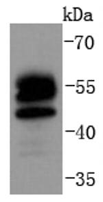 FOXO4 Antibody in Western Blot (WB)