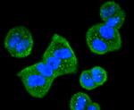 HDAC10 Antibody in Immunocytochemistry (ICC/IF)