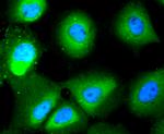 HDAC10 Antibody in Immunocytochemistry (ICC/IF)