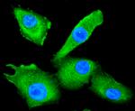 HDAC10 Antibody in Immunocytochemistry (ICC/IF)